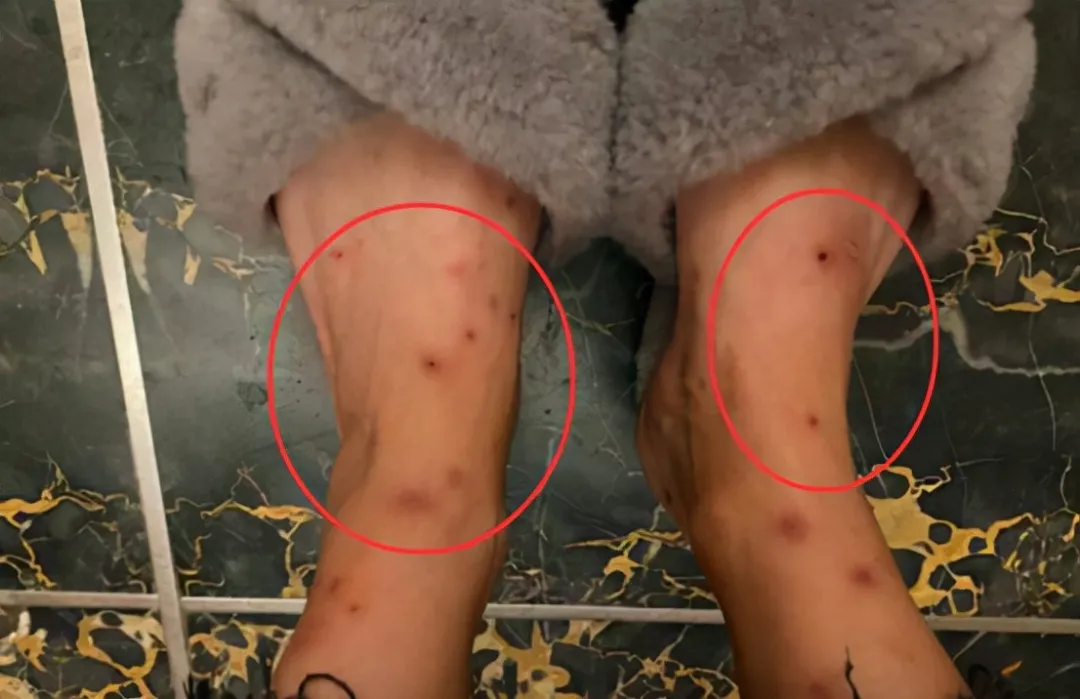一小區(qū)跳蚤泛濫！跳蚤究竟哪來的？